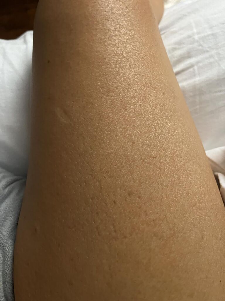 Coco & Eve Sunny Honey Self Tanner Foam - (Medium) Fast Drying, Streak-Free Sunless Tanning Mousse, Tropically Scented Lightweight Natural Looking Tan, Non-Sticky, Vegan, Cruelty Free | 6.7 Fl Oz customer photo 2