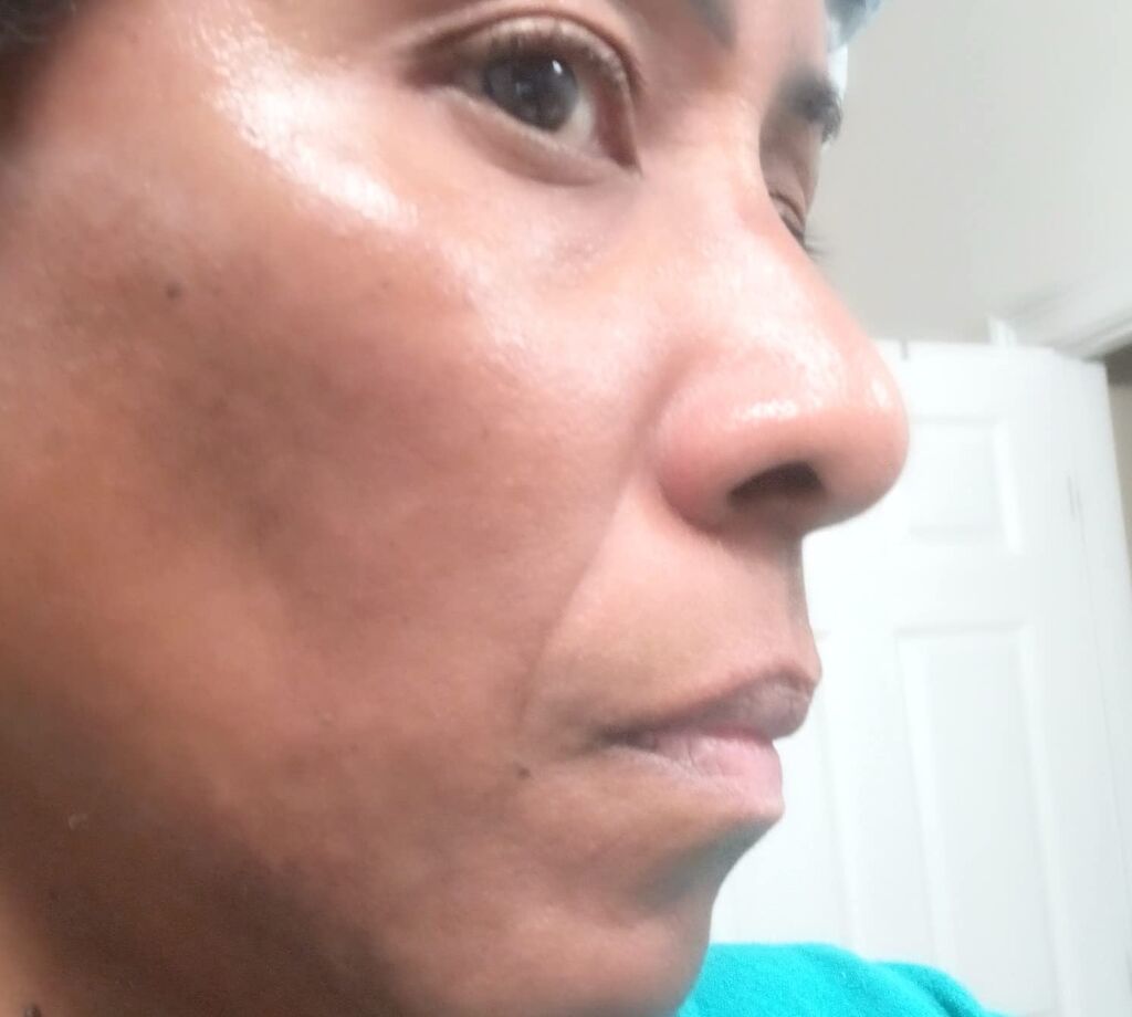 Eva Naturals Vitamin C Serum for Face - Anti Aging Dark Spot Remover with Retinol, Hyaluronic Acid, Niacinamide & Salicylic Acid customer photo 1