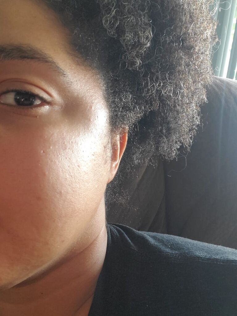 TruSkin Vitamin C Super Serum - Five Benefits in One with Vitamin C, Retinol, Niacinamide, Hyaluronic Acid & Squalane (1 fl oz) customer photo 2