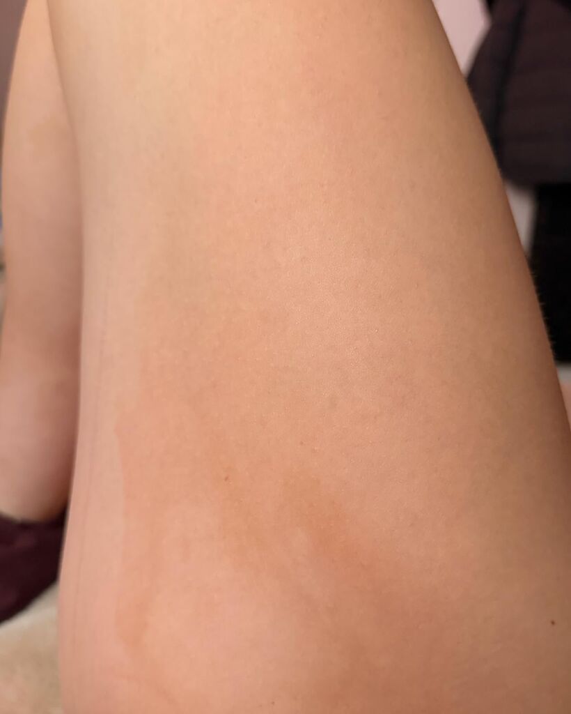 Tanologist Medium Self Tan Mousse, Self-Tanning Mousse, Streak-Free, Natural Glow, No Fake Tan Smell Or Orange Tone, Long Lasting, Clean Ingredients, Vegan, 6.76 fl. oz customer photo 1