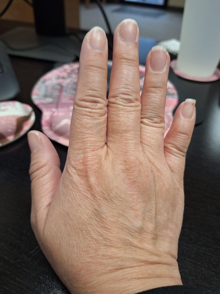 Glow Recipe Plum Plump Hyaluronic Acid Serum - Hydrating + Plumping Face Serum with Vitamin B5, Barrier Support + Antioxidants (30ml) customer photo 1