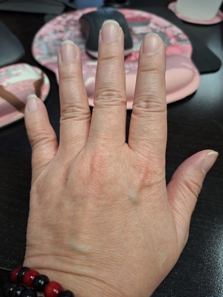 Glow Recipe Plum Plump Hyaluronic Acid Serum - Hydrating + Plumping Face Serum with Vitamin B5, Barrier Support + Antioxidants (30ml) customer photo 2