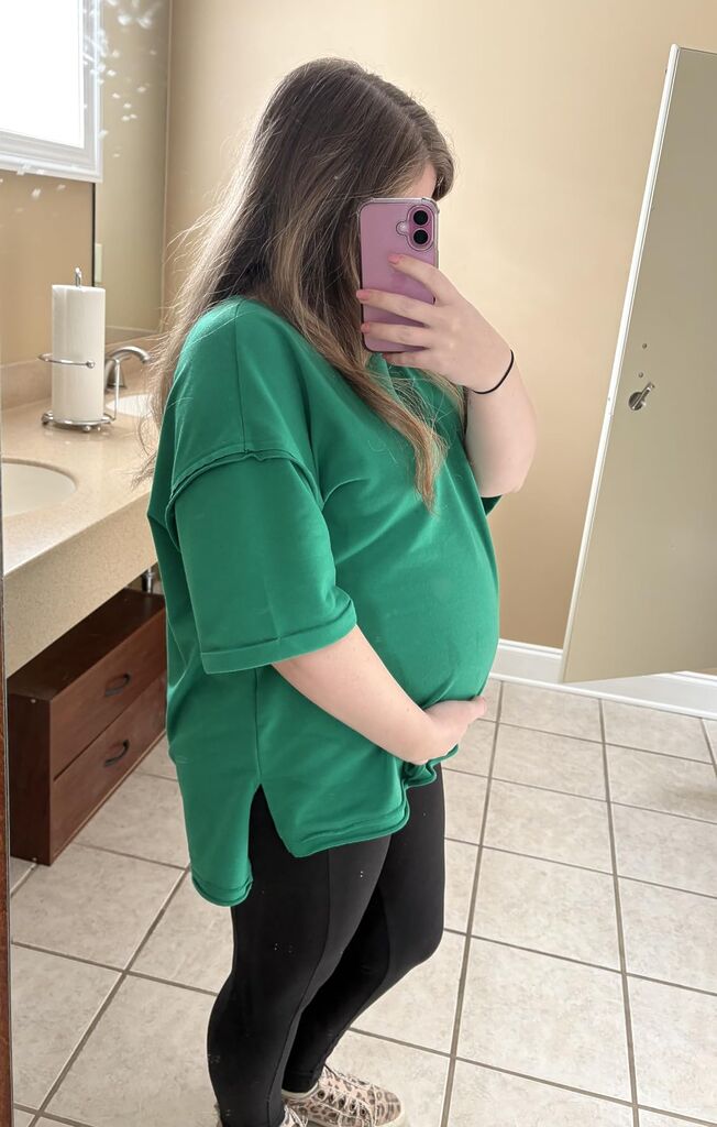 RUBZOOF Women's Oversized T Shirts Short Sleeve Side Split Tops Casual Shirts Tunic Maternity customer photo 1